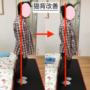 猫背改善　ビフォーアフター