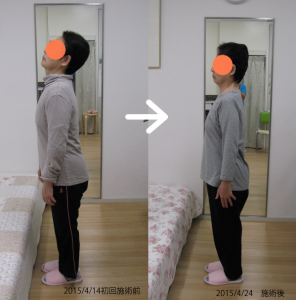 体の歪み 上しか向けません