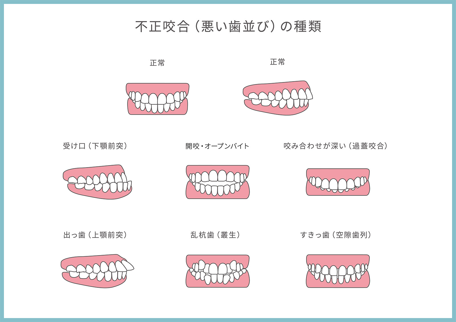 骨格を放っておいて歯だけを治すだけでいいのか？by　銀座エルディアクリニック　副院長　歯科医　吉野純子先生