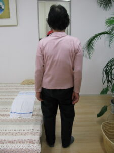 猫背 アフター