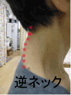 高すぎる枕で寝ると、逆ネックに。